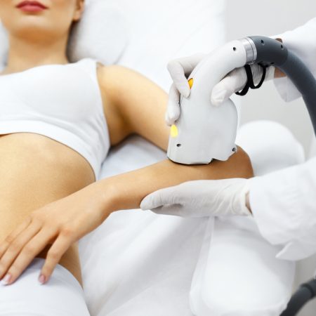 epilation-definitive épilation définitive